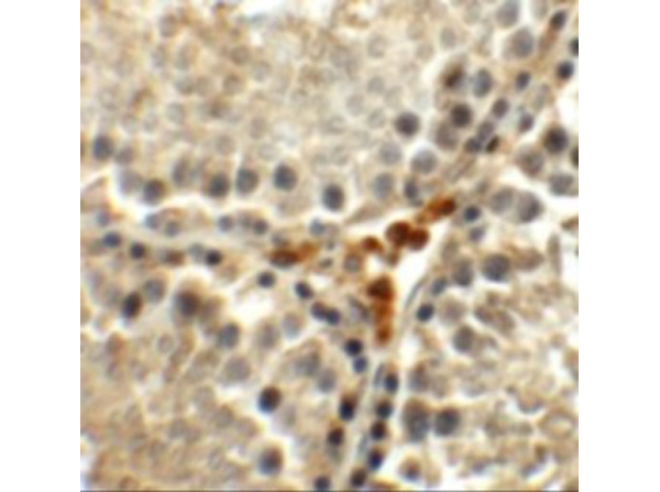 Immunohistochemistry results of MEIG1