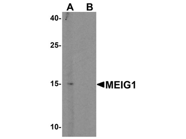 Western blot analysis of MEIG