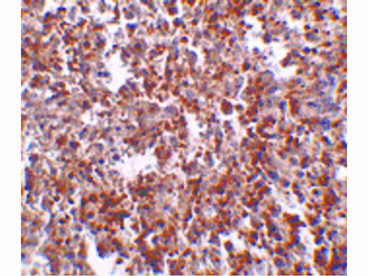 Immunohistochemistry of MettL7B Antibody