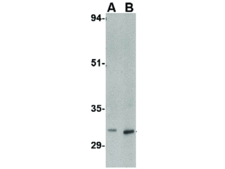 Western Blot of MettL7B Antibody