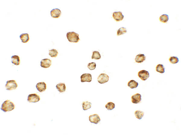 Immunocytochemistry of MFN1 Antibody