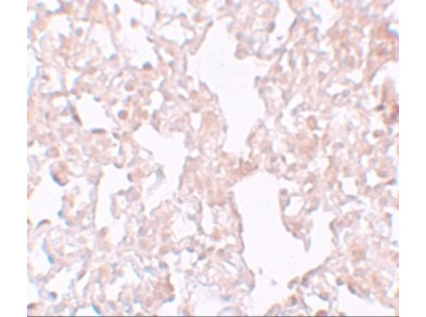 Immunohistochemistry of MFSD1