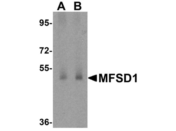 Western blot analysis of MFSD1