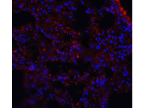 Immunofluorescence of MFSD2A