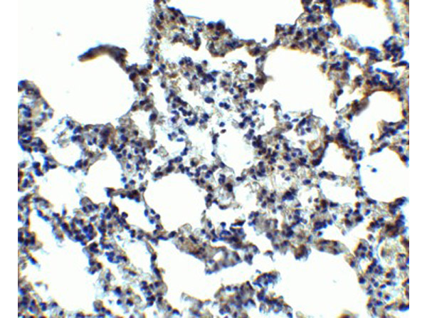 Immunohistochemistry of MFSD2A