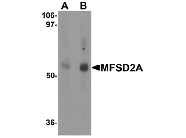 Western blot analysis of MFSD2A