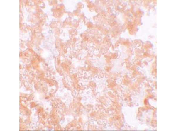 Immunohistochemistry of MFSD2A