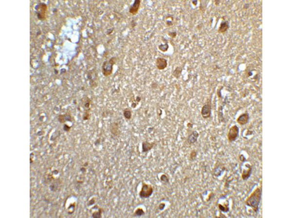 Immunohistochemistry of MFSD2A