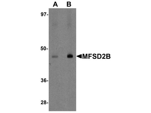 Western blot analysis of MFSD2B