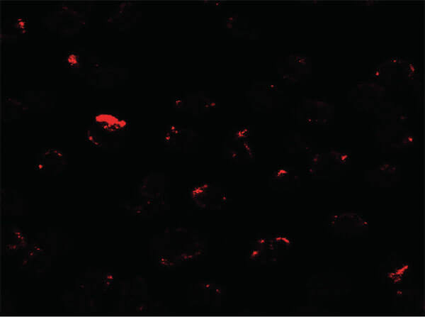 Immunofluorescence of MIB1 Antibody