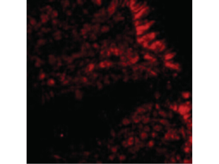 Immunofluorescence of MICA Antibody