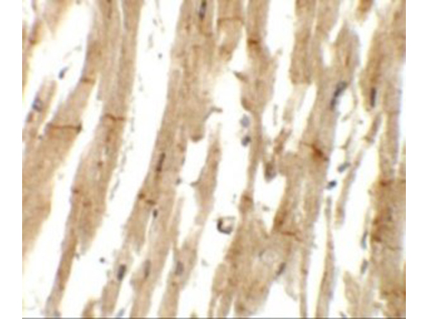 Immunohistochemistry of MLIP