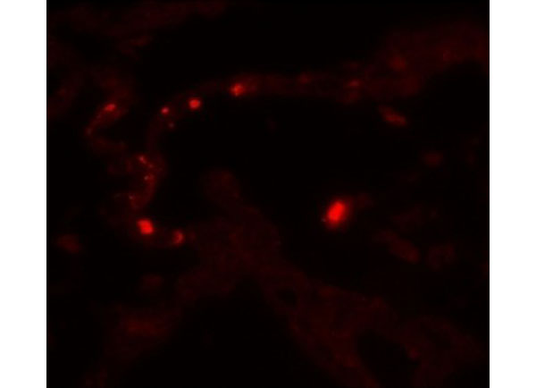 Immunofluorescence of MMP9