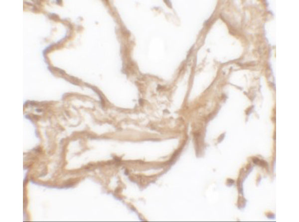 Immunohistochemistry of MMP9