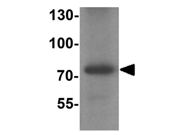Western blot of MMP9