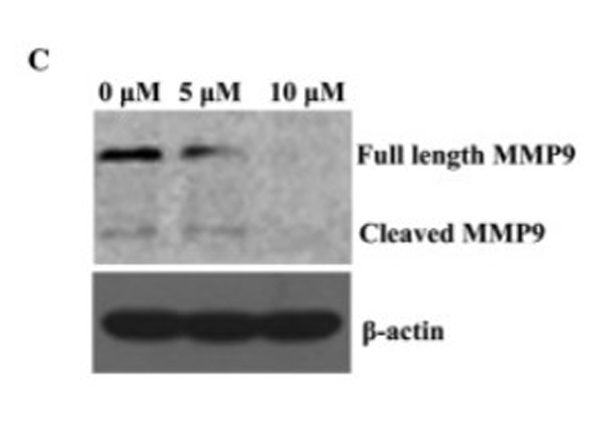 Western Blot using MMP9