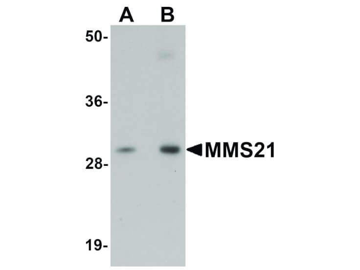 Western Blot of MMS21 Antibody