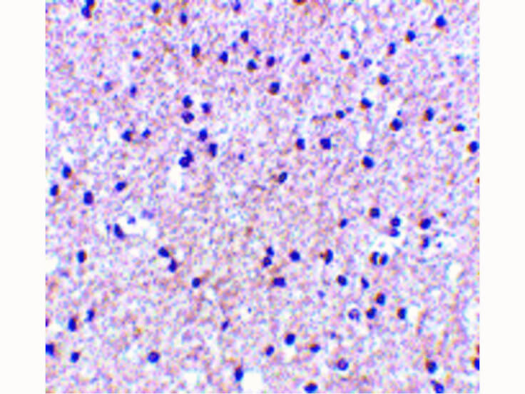 Immunohistochemistry of MORF4 Antibody