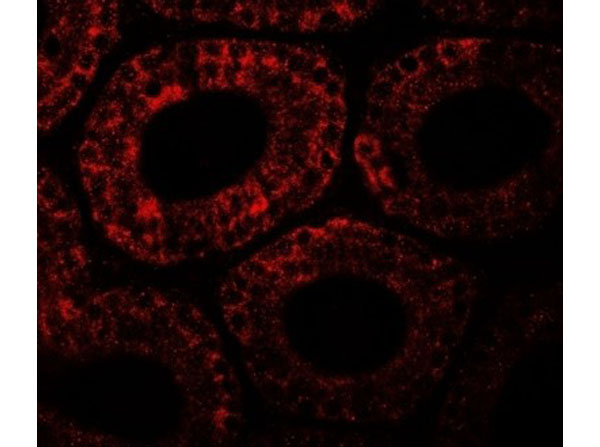 Immunofluorescence of MOSPD1