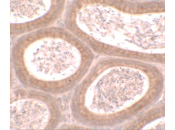 Immunohistochemistry of MOSPD1