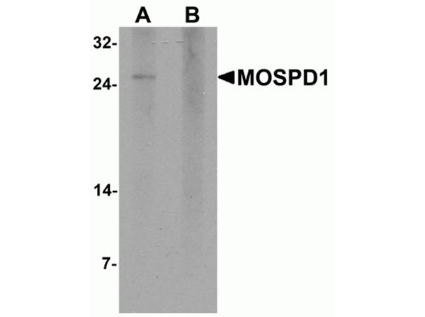 Western blot analysis of MOSPD1