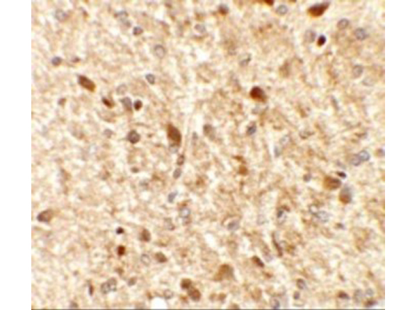 Immunohistochemistry of MS4A6A