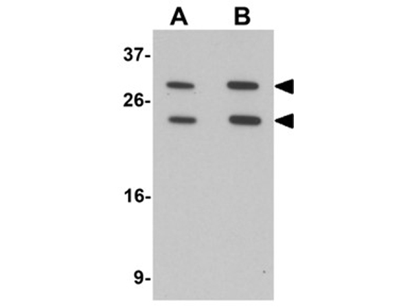 Western blot analysis of MS4A6A