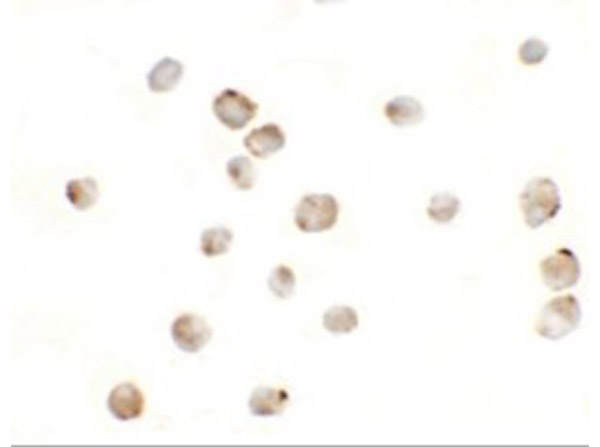 Immunocytochemistry of MSI2