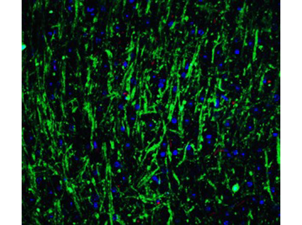 Immunofluorescence of MSI2