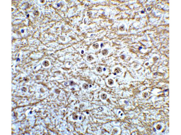 Immunohistochemistry of MSI2