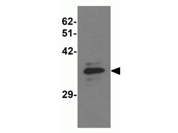 Western blot analysis of MSI2