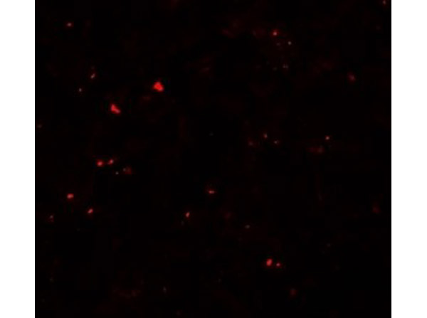Immunofluorescence of MSI2
