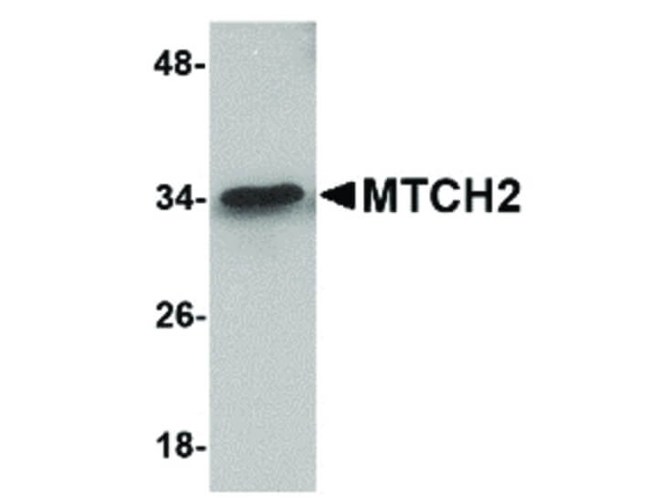 Western Blot of MTCH2 Antibody