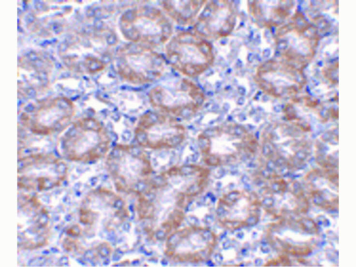 Immunohistochemistry of MTCH2 Antibody