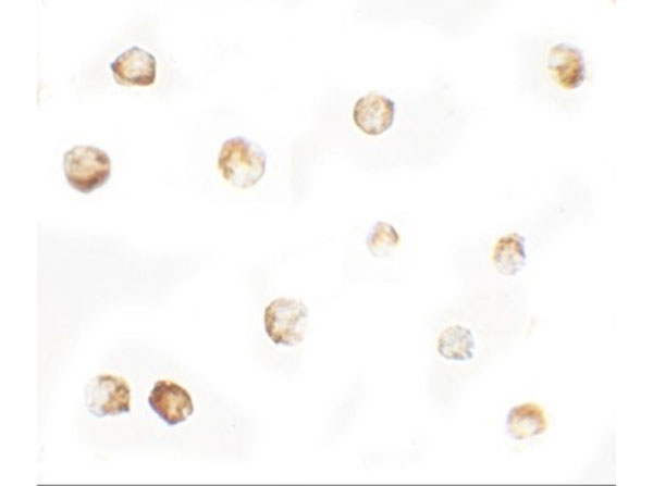 Immunocytochemistry of MTERFD1