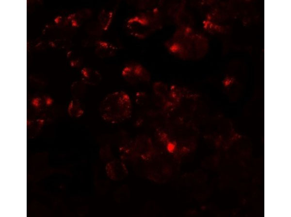 Immunofluorescence of MTERFD1