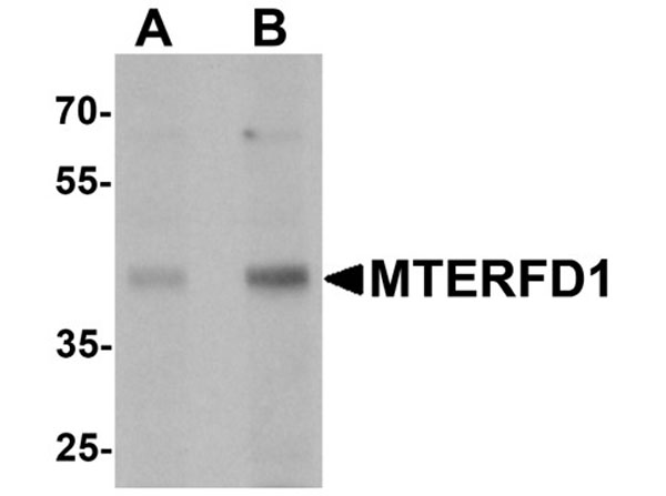 Western blot analysis of MTERFD1