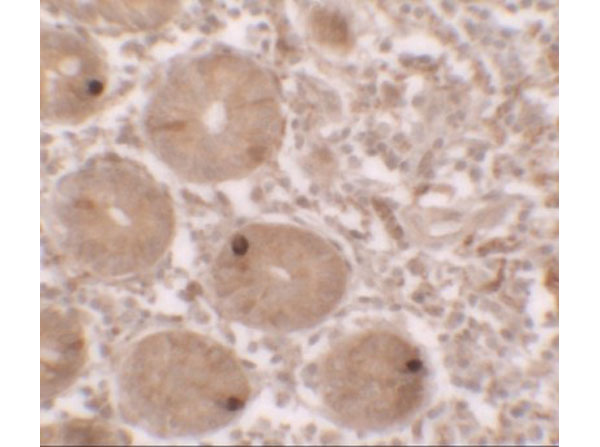 Immunohistochemistry of MTERFD2