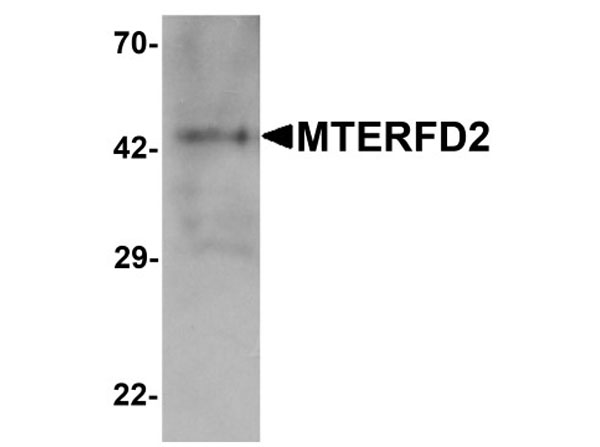 Western blot analysis of MTERFD2