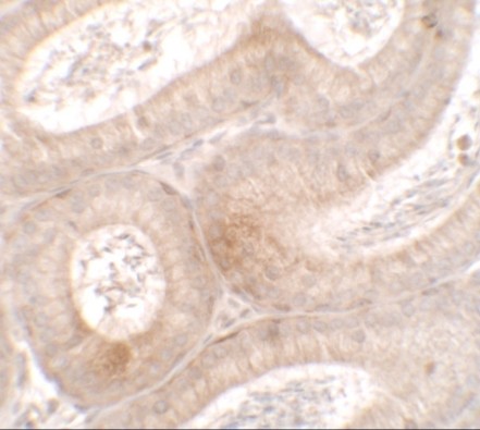 Immunohistochemistry of MTERFD3