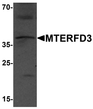 Western blot analysis of MTERFD3