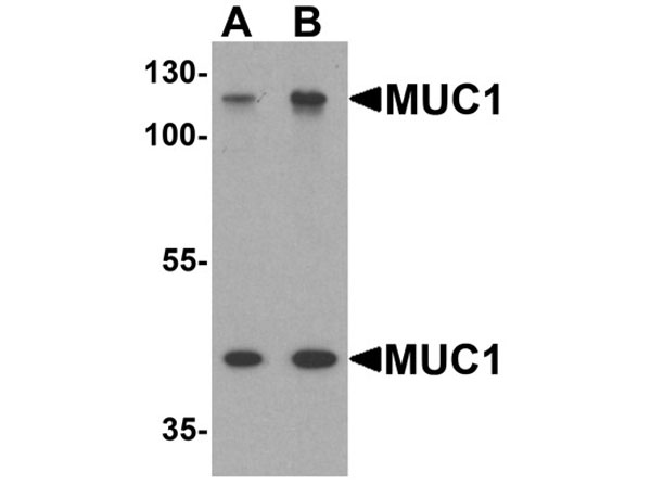 Western blot of MUC1