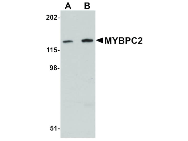 Western Blot of MYBPC2 Antibody