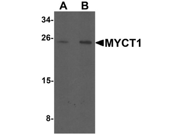 Western blot analysis of MYCT1