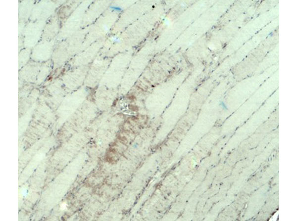 Immunohistochemistry of MYH3