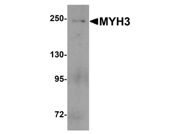 Western blot of MYH3