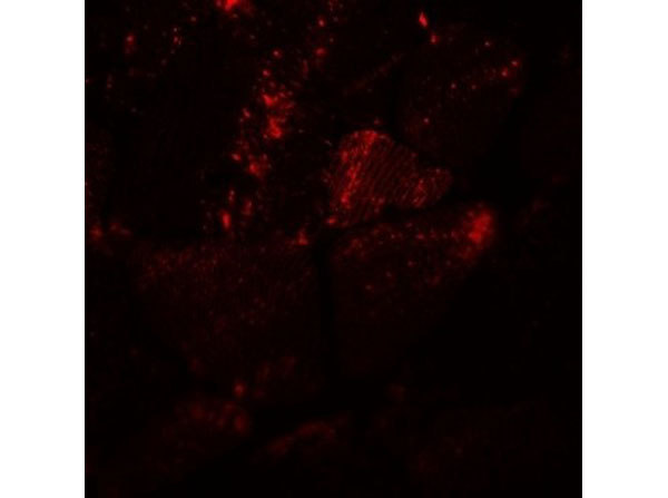 Immunofluorescence of MYH8