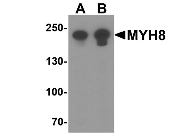 Western blot of MYH8