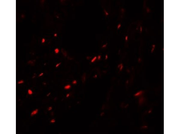Immunofluorescence of MYOZAP