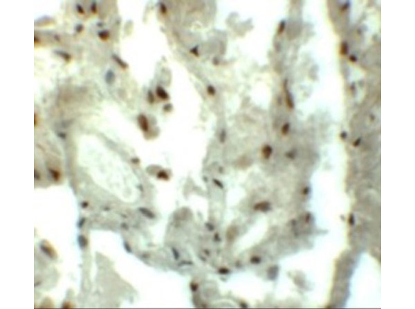Immunohistochemistry of MYOZAP